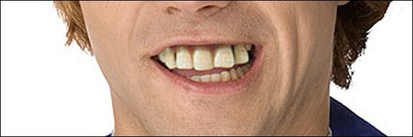 the-british-have-horrible-teeth-1317854